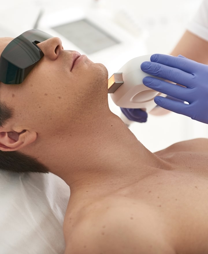 Depilación Láser de diodo facial