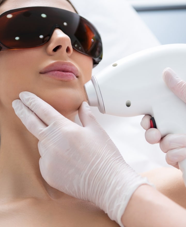 Depilación Láser de diodo facial
