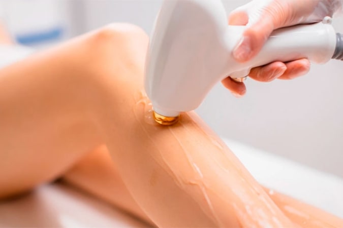 Sesiones depilación láser